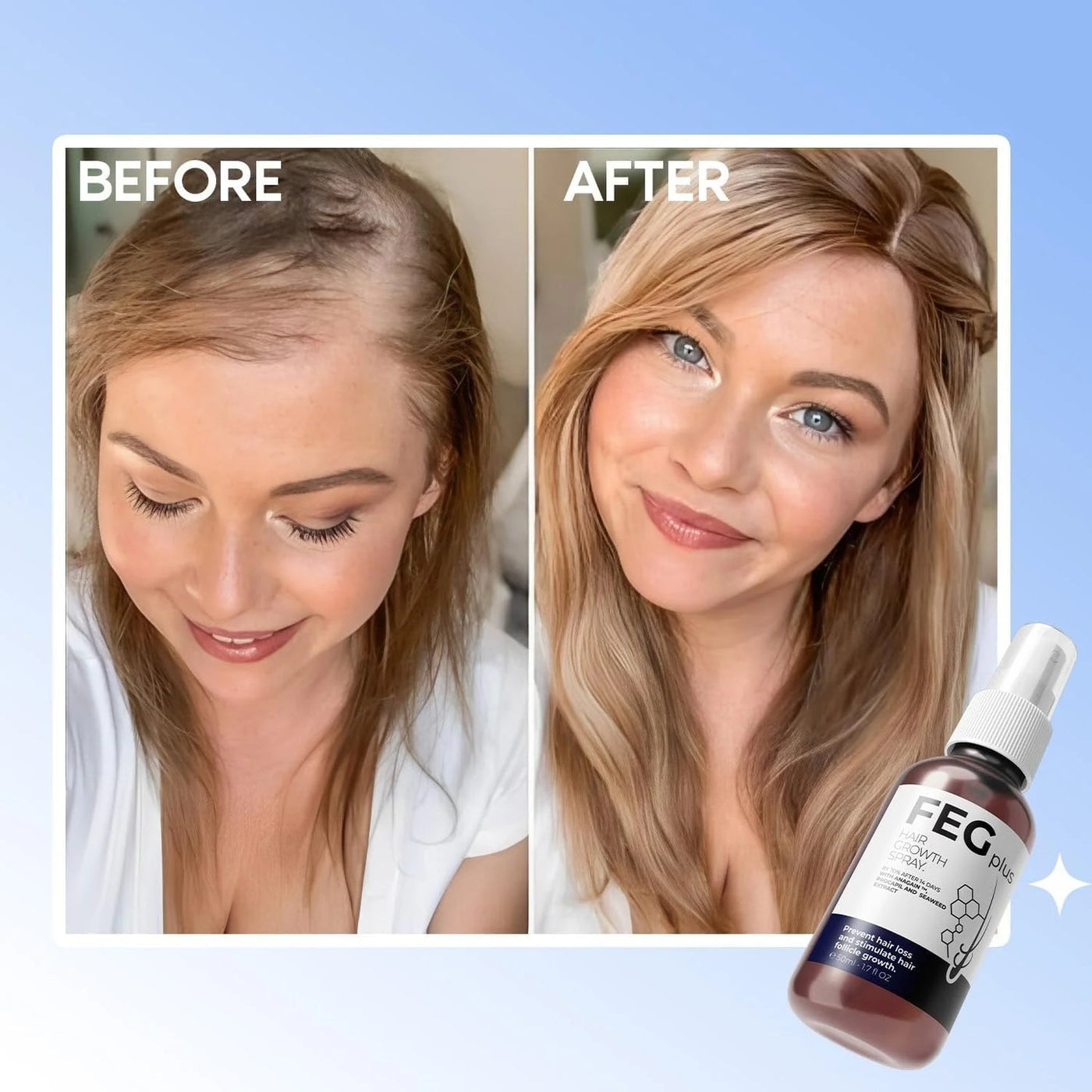 New 2025 Voted: #1 Hair Growth Solution